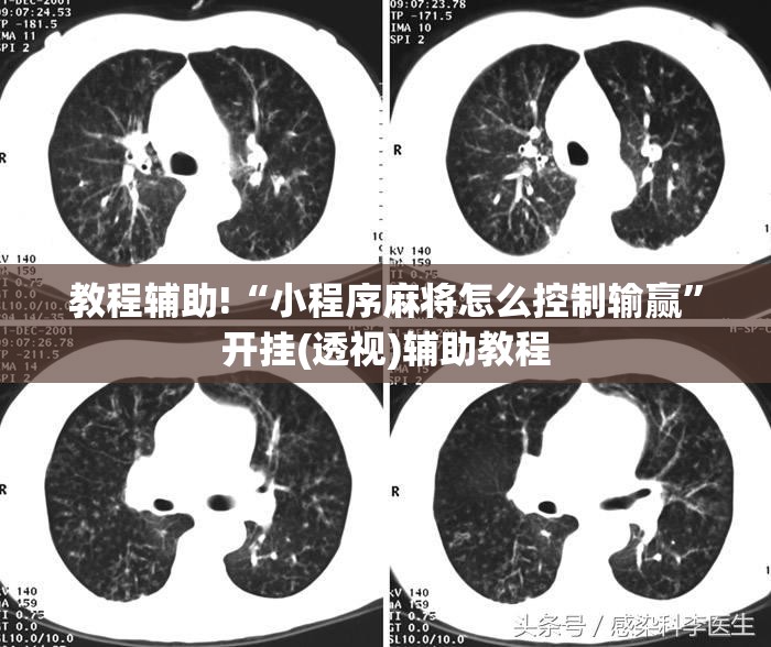 教程辅助!“小程序麻将怎么控制输赢”开挂(透视)辅助教程