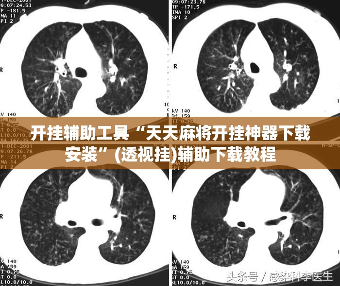开挂辅助工具“天天麻将开挂神器下载安装	”(透视挂)辅助下载教程
