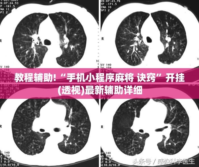 教程辅助!“手机小程序麻将 诀窍”开挂(透视)最新辅助详细